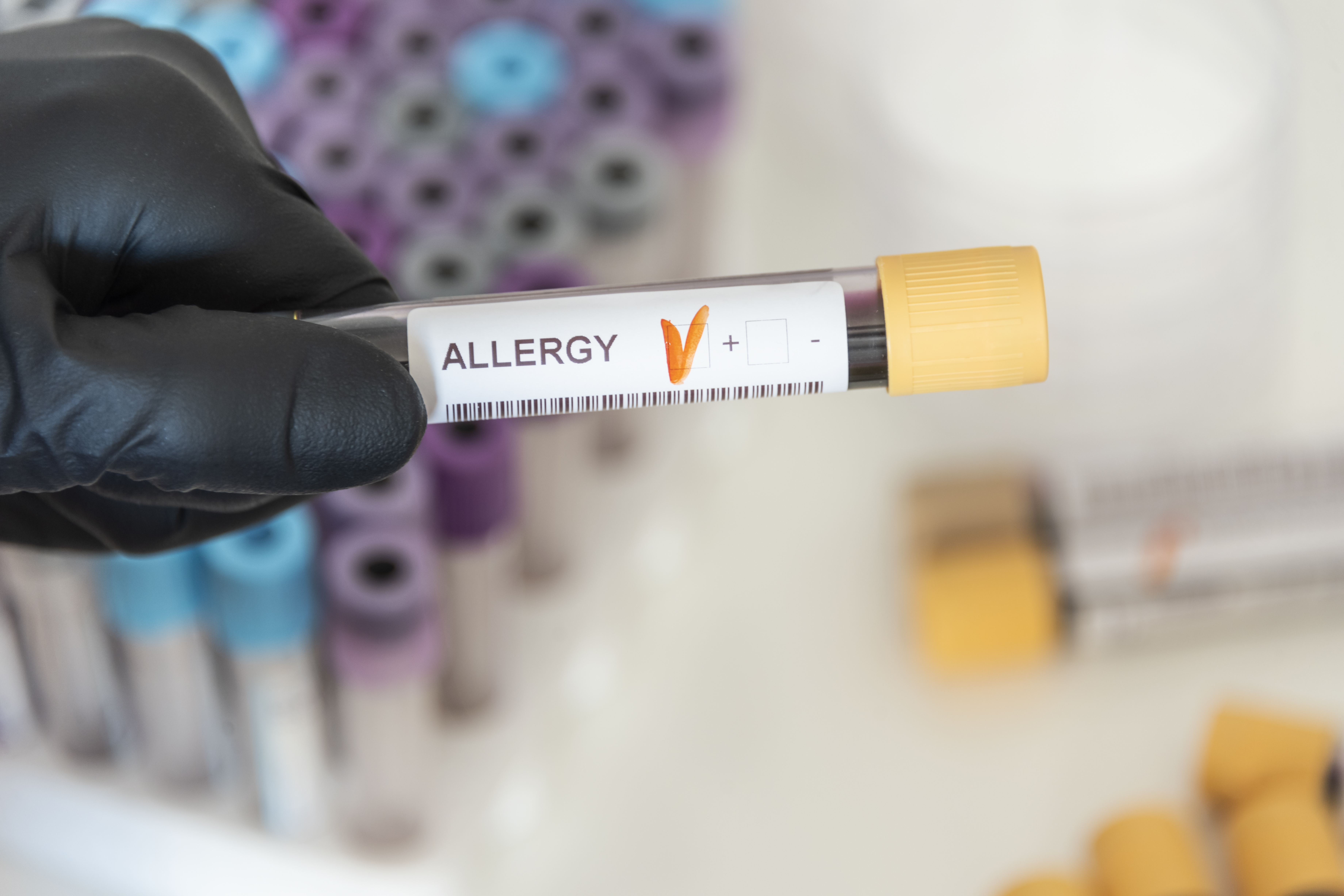 patient blood sample testing positive for allergy